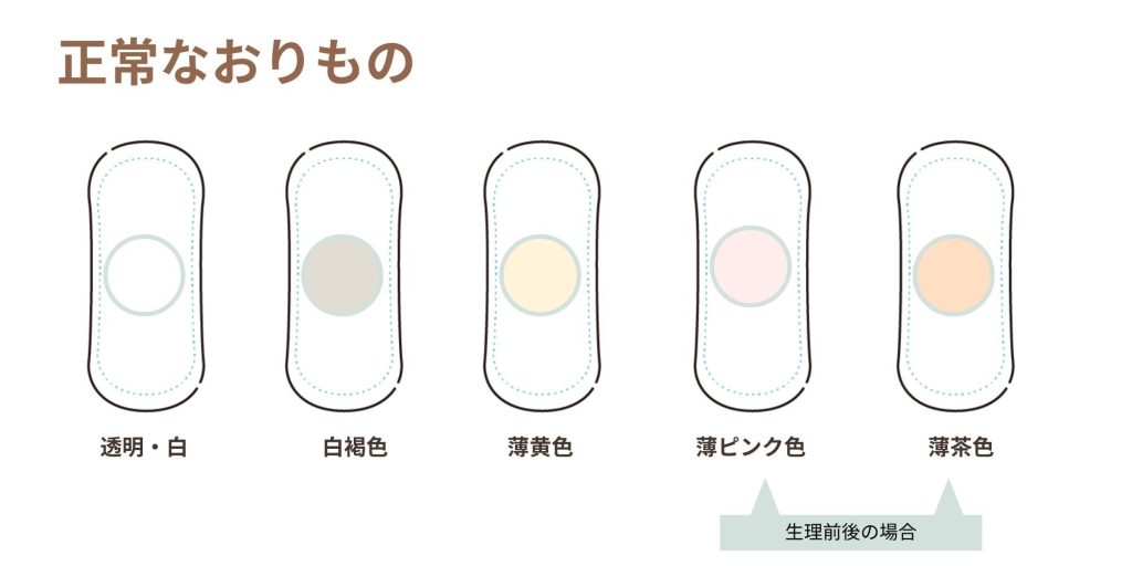 他の分泌物はどうですか?